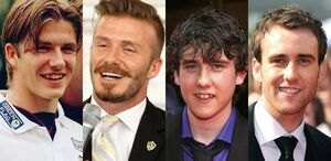 Ők sem hollywoodi mosollyal születtek – 10 híresség megdöbbentő átalakulása