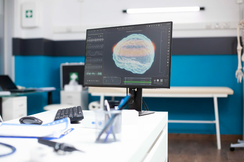 Áttörést hozhat a HUN-REN kutatóinak eljárása a skizofrénia megértésben