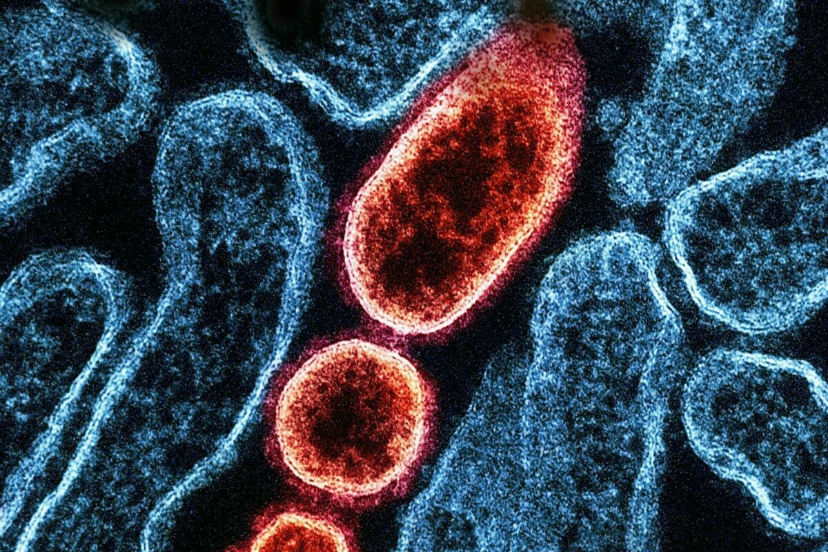 Felütötte a fejét egy halálos vírus: küszöbön az új világjárvány?
