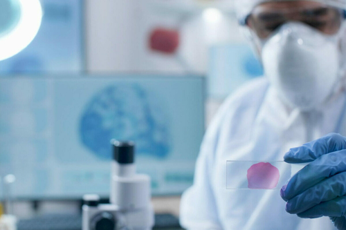 Személyre szabott onkológia: Hogyan válthatja fel az immunterápia a hagyományos kezeléseket?